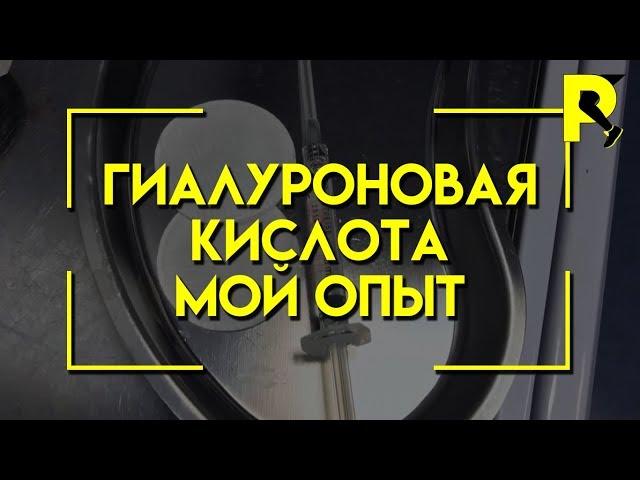 Гиалуроновая кислота. Укол в сустав. Реабилитация после пластики передней крестообразной связки(ПКС)