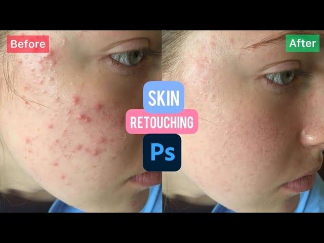 Easy skin retouching in another level for beginners only.. ( photoshop tutorial )