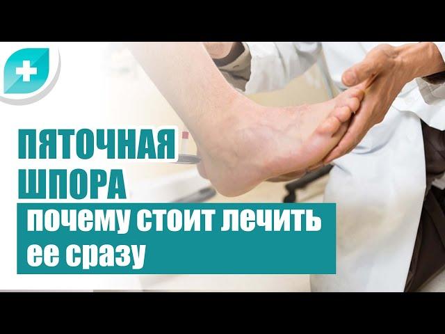 Пяточная шпора: почему стоит лечить ее сразу?