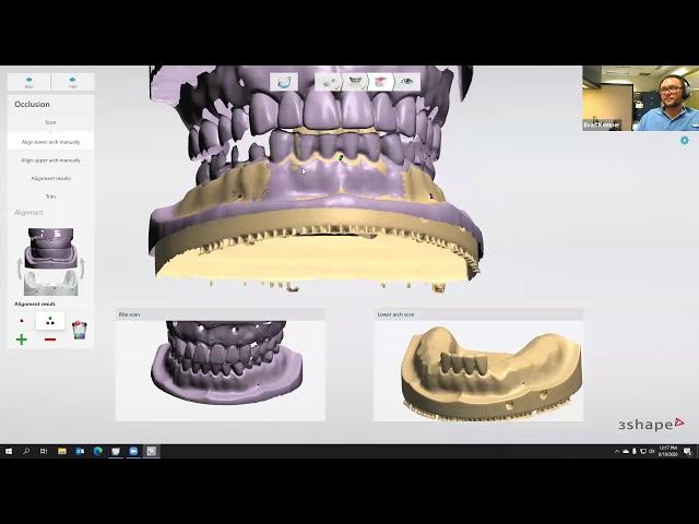 Digital Dentistry Training Series: Advanced Denture Design