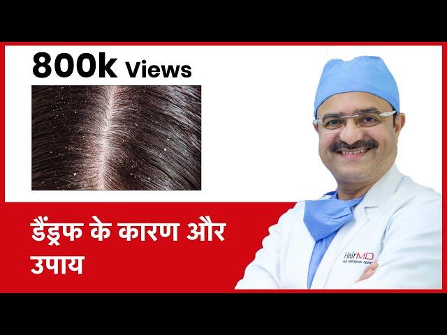 How To Get Rid Of Dandruff ( डैंड्रफ के कारण और उपाय) | HairMD, Pune | (In HINDI)