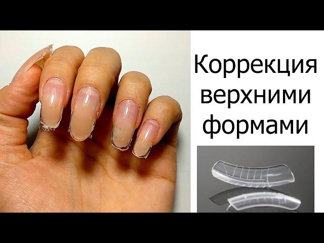 КОРРЕКЦИЯ верхними ФОРМАМИ.Клюющие ногти.ТРЕЩИНЫ в точках вроста