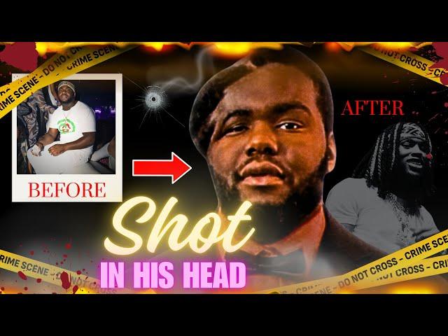 Chicago Hitman Survives Headshot Just to Be Arrested For Murder