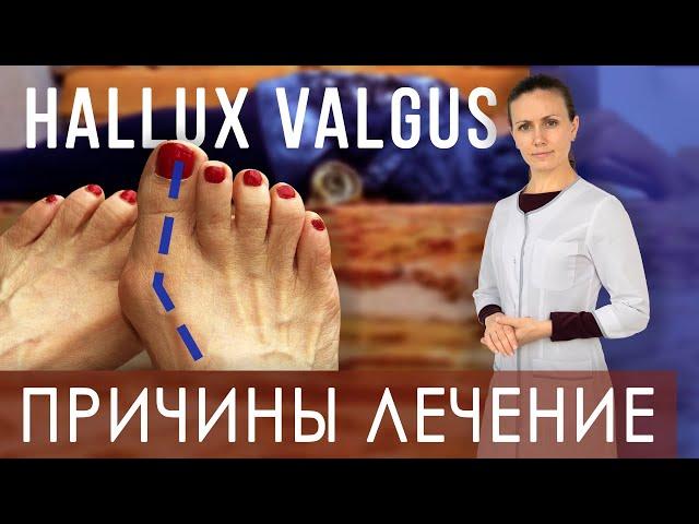 Косточка на ноге. Лечение Hallux valgus дома. Валик под спину | Как правильно лежать на валике