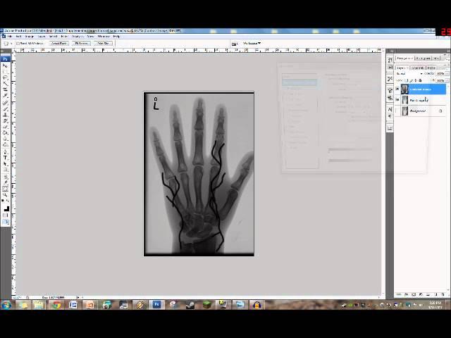 Subtraction Imaging Explained