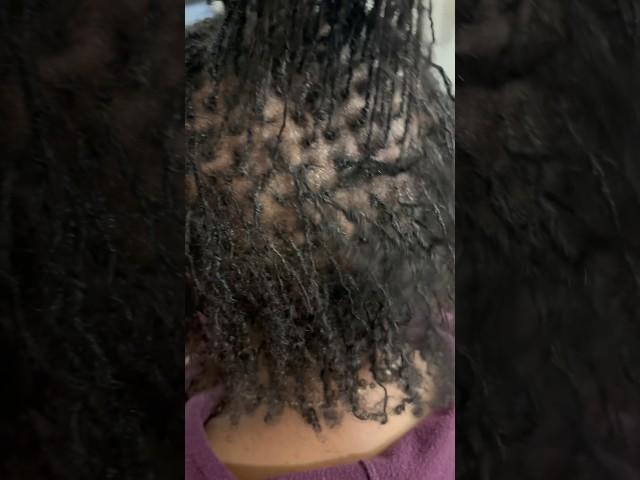 5 months in, & moms #sisterlocks are thriving her Fine hair is giving growth,health,& beauty