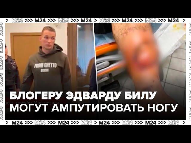 Блогеру Эдварду Билу могут ампутировать ногу - Москва 24