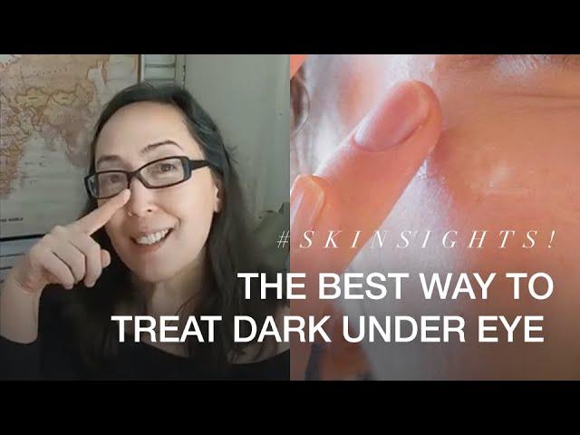 The Best Way To Treat Dark Under Eye | VMV Hypoallergenics Snippet