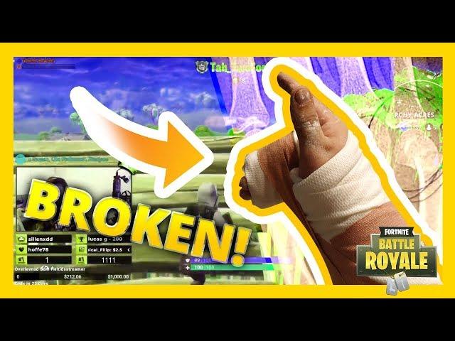 I BROKE MY HAND DURING A FORTNITE GAME!