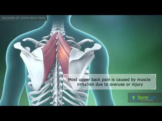 Upper Back Pain Reasons