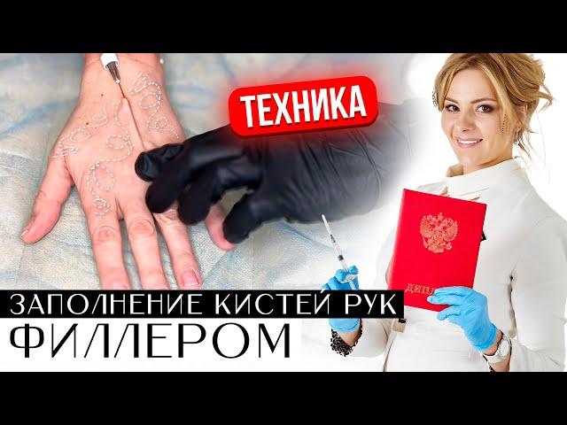 Заполнение кистей рук филлером. Техника. Восстановление объема и качества кожи кистей рук.