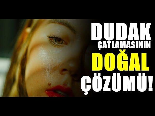 Dudak çatlamasına ne iyi gelir?