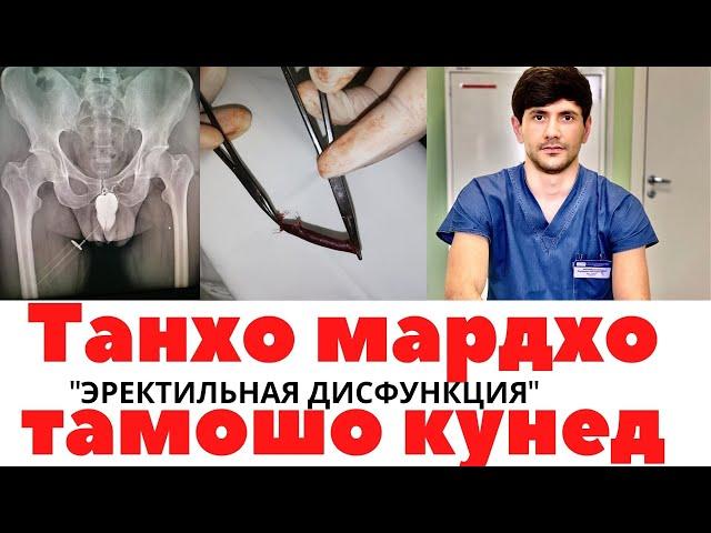 СОЗ НАХЕСТАНИ УЗВИ МАРДОНА/ЭРЕКТИЛЬНАЯ ДИСФУНКЦИЯ. САБАБХОИ АСОСИ КИ БА ИН  БЕМОРИ ОВАРДА МЕРАСОНАД