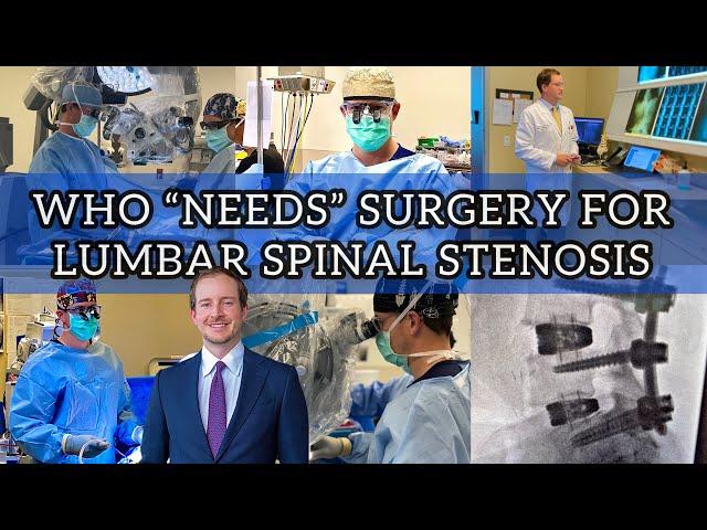 Who NEEDS Surgery For Lumbar Spinal Stenosis (Part 3)