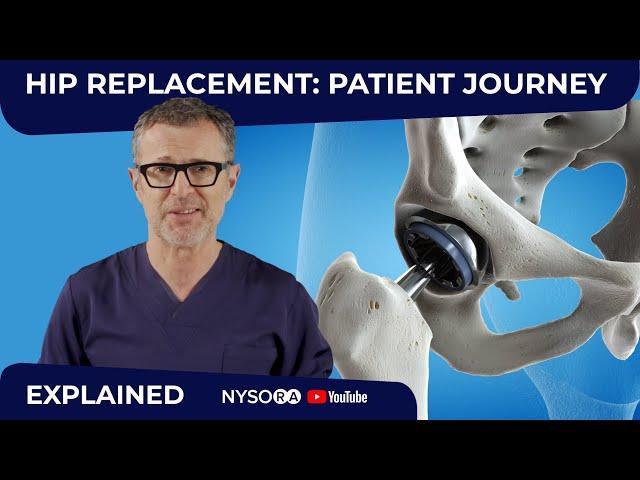 HIP REPLACEMENT SURGERY: WHAT TO EXPECT?