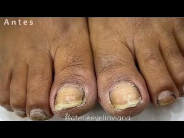 Impressionante essa CUTILAGEM BEM feita! passo a passo manicure iniciantes