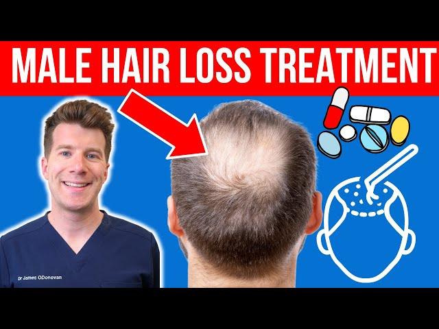 Doctor explains Male Hair Loss Treatment