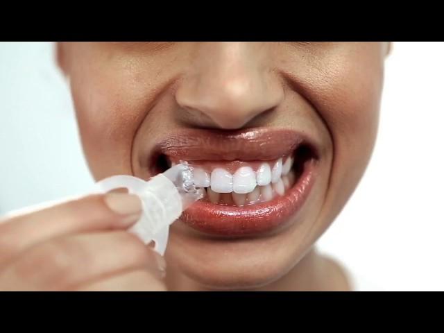 Introducing the GLO Lit Teeth Whitening Tech Kit with Bluetooth and the GLO Whitening App