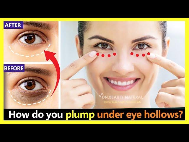 How to get rid Sunken eyes, Under-eye hollows and plump Naturally | Face Exercises & Massage.