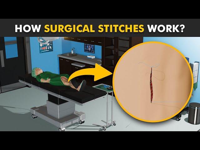 How Stitches Work In Body? (3D Animation) | Healing Process Of Surgical Wounds