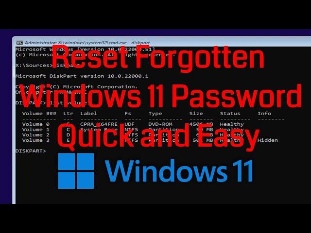 Reset Password Windows 11 via Command Prompt CMD [Tutorial]