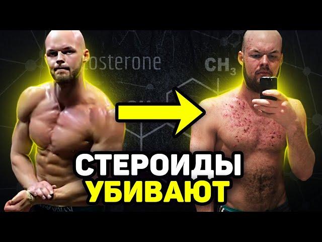 3 ГОДА НА СТЕРОИДАХ / необратимые последствия