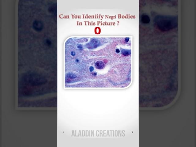 Can you identify Negri Bodies ?   #Quiz 64