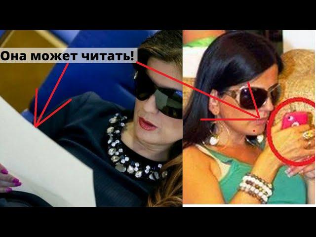 Что скрывала Диана Гурцкая под очками. Такого не ожидал никто!