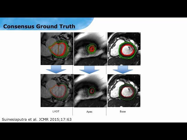 ISMRM MR Academy - Systolic Function