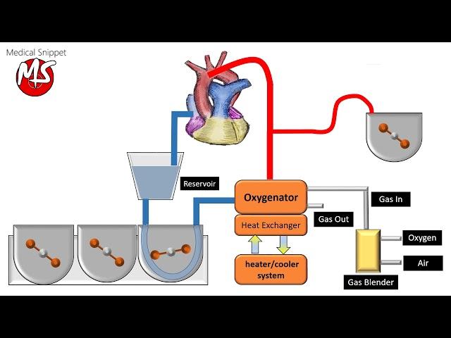 Cardiopulmonary bypass (CPB) circuit