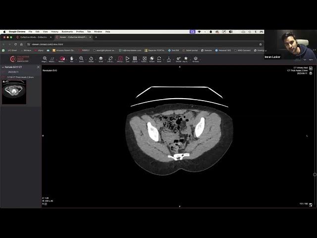 Master CT Scan of urinary track with Dr. Lasker  #radiology #ctimaging  #medicalcourse #medicaldegre