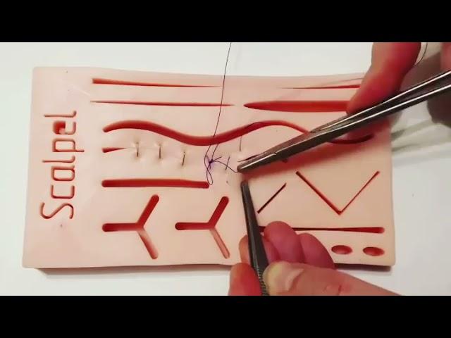 Непрерывный обвивной хирургический шов \ Continuous wraparound surgical suture