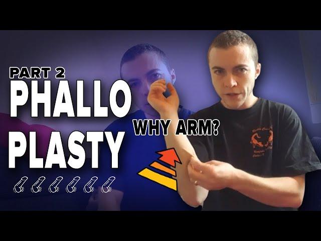 Visuals Phalloplasty: Issue 2 (why hand and what are the pros and cons)