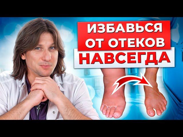 СТРАШНЫЕ последствия ОТЕКОВ! Эти эффективные упражнения избавят от ОТЕКОВ