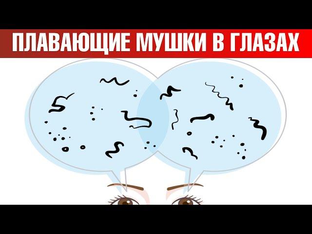 Как избавиться от мушек в глазах? Мушки перед глазами: причины