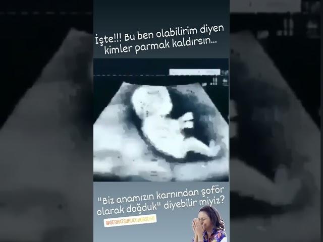 gülmek serbest 