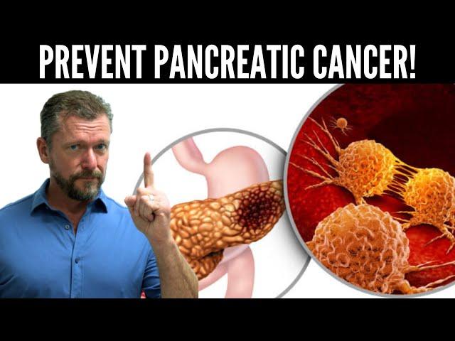 Lower Pancreatic Cancer Risk (Pancreas Cancer Risk Test)