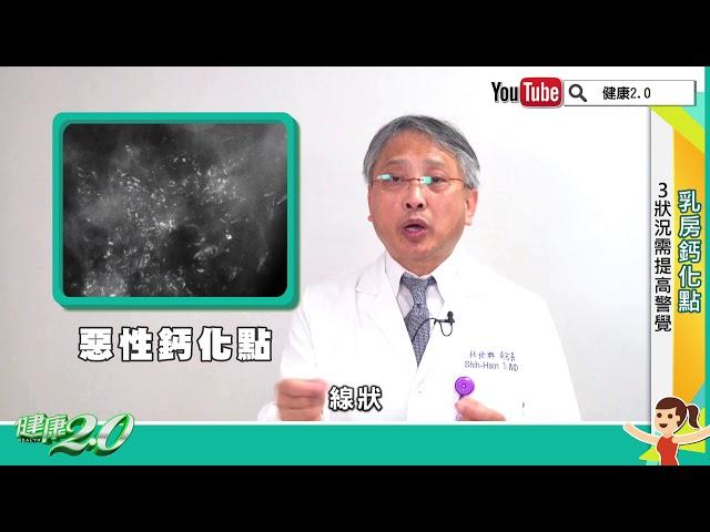 【名醫觀點】乳房有鈣化點別慌！8成以上是良性，3狀況需提高警覺