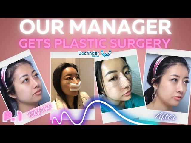 Docfinderkorea manager gets plastic surgery! Part 1