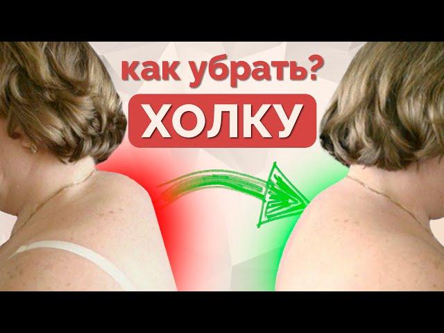 Как убрать вдовий горб? Упражнения от холки.