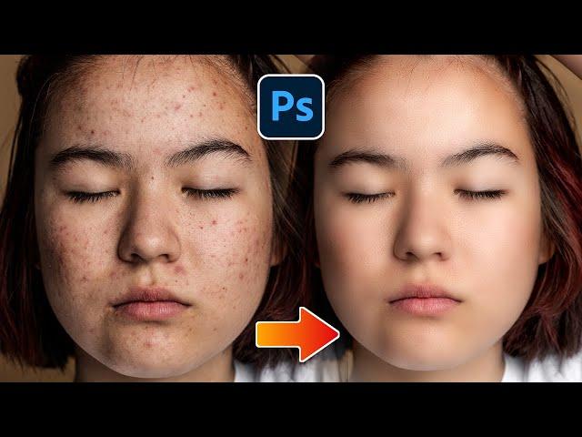 Face Retouching Best Photoshop Tricks || Skin Retouching || DK ARNIYA