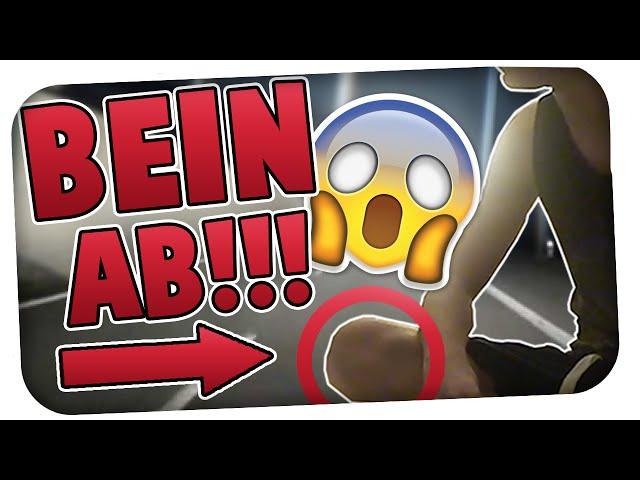 HEFTIGER UNFALL!! - FREUND VERLIERT BEIN!!! | AniBeast