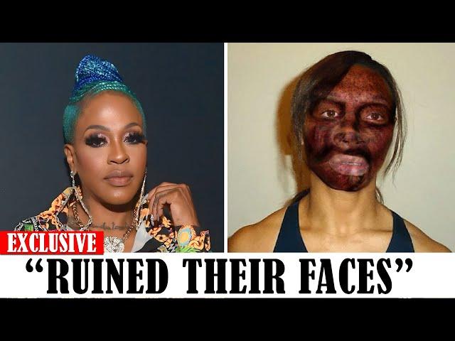 20 Black celebrities Who RUINED Their Careers With PLASTIC SURGERY