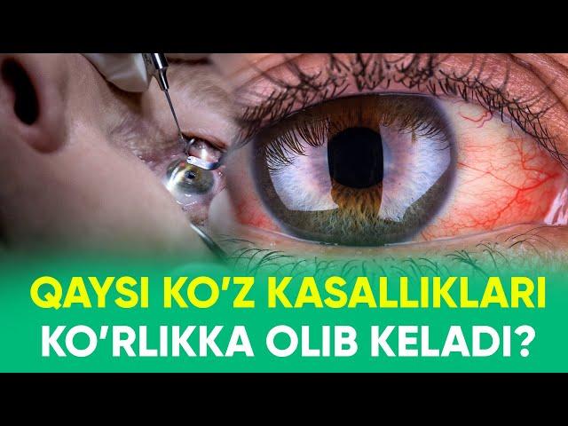 Qaysi ko'z kasalliklari ko'rlikka olib keladi ? - MEDO