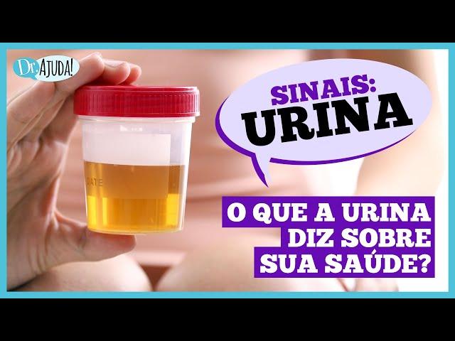 What Your URINE Shows About Your HEALTH: 11 Signs #urine #kidneys