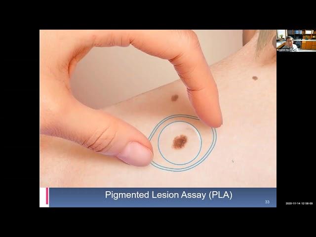 Skin Cancer Diagnosis and Misdiagnosis with Benjamin Hsu, MD