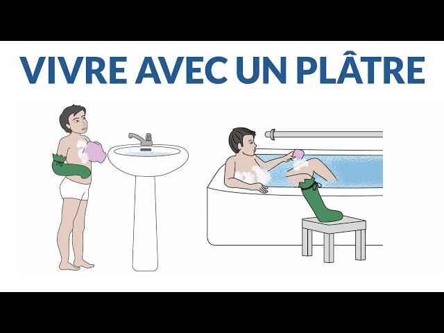 Comment vivre avec un plâtre ?