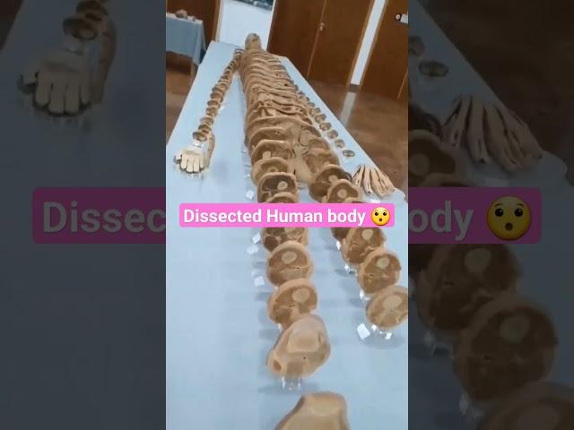 Dissected Human body  #mbbs #medico #students #doctor #study #hostellife #kota #medicalcollege