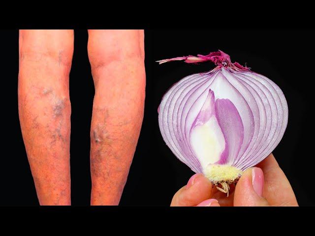 Unbelievable!  It's a varicose vein killer! Erases varicose veins like an eraser!2 recipes