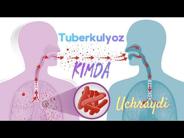 Tuberkulyoz haqida nimalarni bilish kerak!